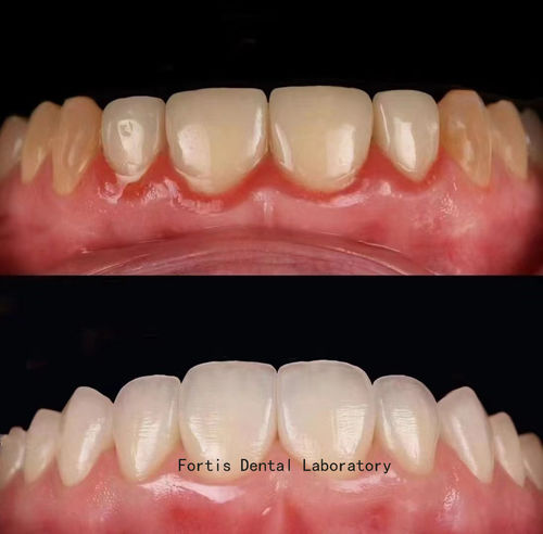 Latest company case about Case 10