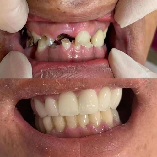 Latest company case about Customer Feedback (3)