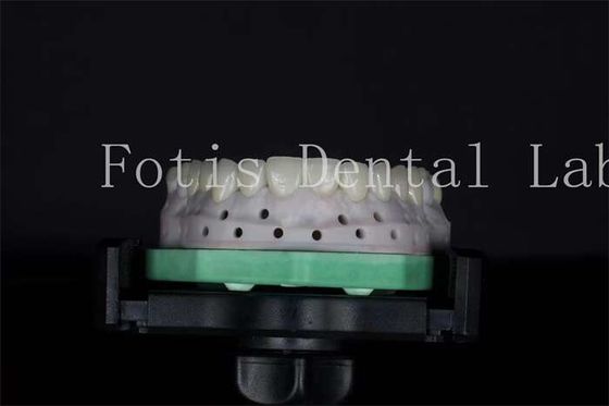 Buy High Strength Dental Lab Veneers Customizable For Natural Smiles online manufacture