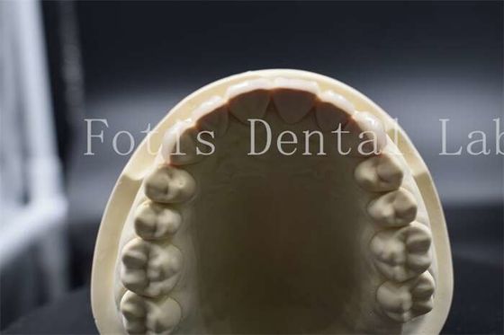Buy High Strength Artificial Teeth Veneers Dentist Porcelain Veneers Natural Looking online manufacture