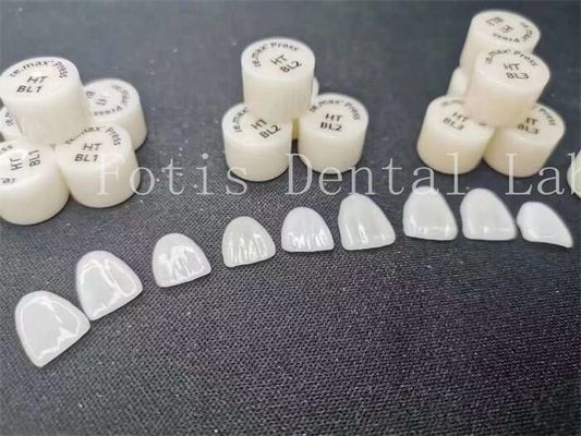 Buy Customization Dental Lab Laminate Veneers with High Stain Resistance and Strength online manufacture