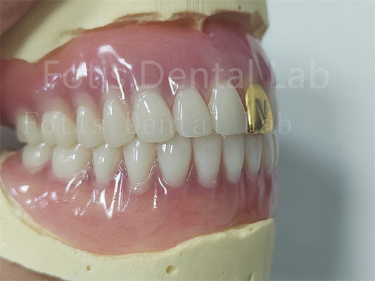 Buy Esthetics Complete Acrylic Denture Set Customizable Fit Easy To Clean online manufacture