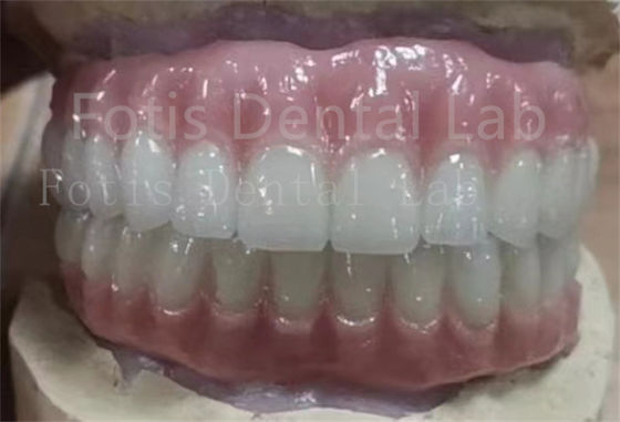 Buy Precise Fit Ivoclar Teeth Acrylic Complete Denture Stain Resistant online manufacture