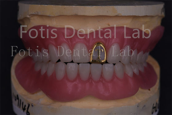 Buy Professional Technicians Acrylic Complete Denture Fake Teeth Prosthetics  Precision Fit online manufacture