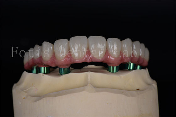 Buy Long lasting Titanium/Zirconia All on 4/6 Implants Easy Maintenance High Success Rate online manufacture