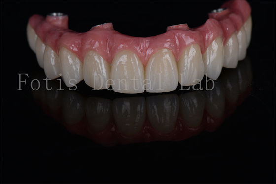 Buy Long-lasting All on 4 All on 6 Dental Implants Minimally Invasive and Easy Maintenance for Low Bone Density Needs online manufacture