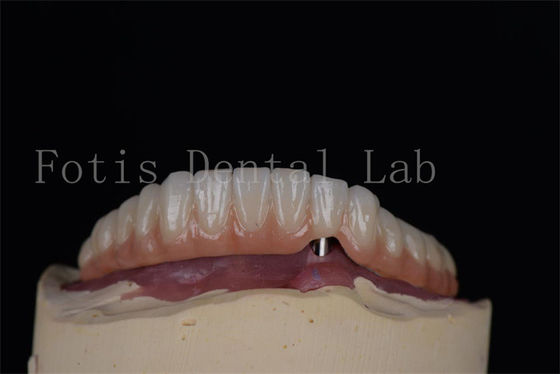 Buy Natural looking Titanium or Zirconia Dental Implants Minimally Invasive Procedure Easy To Clean online manufacture