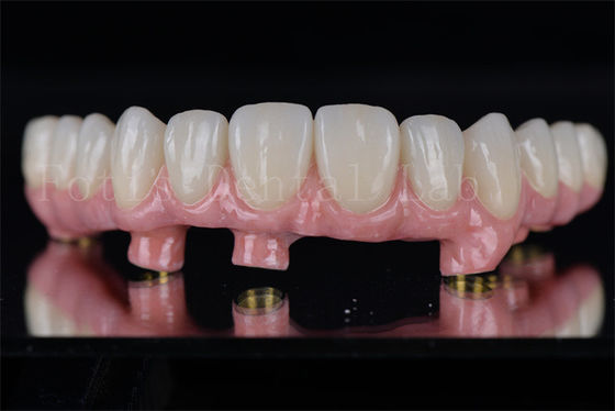 Buy Individual All On 4 All On 6 Dental Implants Restores Full Chewing Ability online manufacture