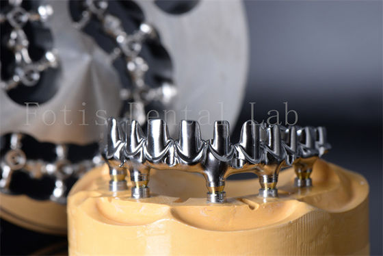 Buy Minimally Invasive Restore Chewing All On 4 All On 6 Titanium Or Zirconia Teeth online manufacture