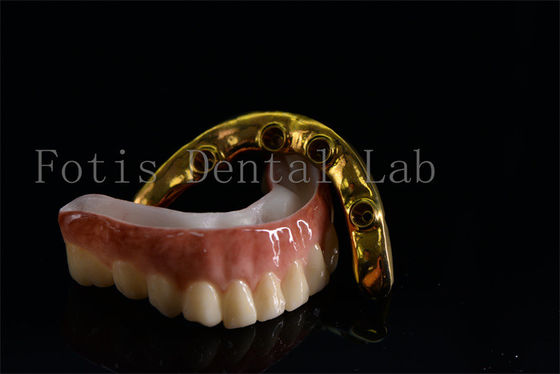 Buy Affordable All On Six Dental Implants Effective Treatment Easy To Clean online manufacture