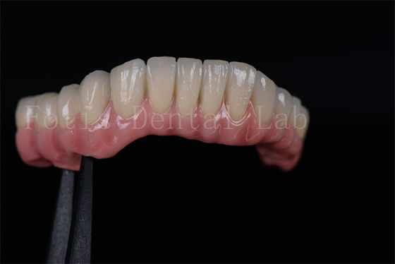 Buy High Success Rate All On Four All On Six  Zirconia Titanium Dental Implants Customized online manufacture