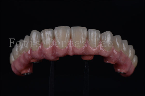 Buy Long Lasting Titanium / Zirconia All On 4 All On 6 Rapid Recovery 1-2 Weeks online manufacture