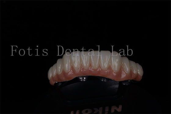 Buy Full Mouth Restoration All On 4 And All On 6 Titanium Or Zirconia Highly Success Rate online manufacture