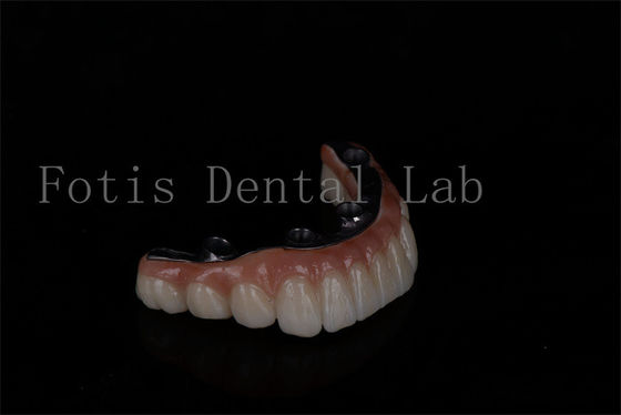 Buy No Age Limit Affordable All On 6 Zirconia Implants Easy Maintenance online manufacture