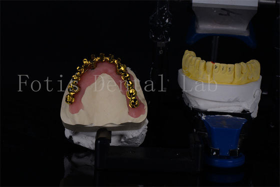 Buy Affordable Titanium / Zirconia All On 4 Dental Implants For Natural Looking Smiles online manufacture