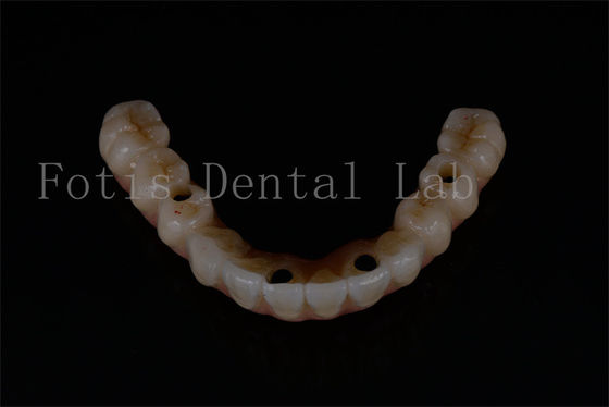 Buy Replacement All On 4 All On 6 Advanced Dental Implants For Optimal Functionality online manufacture