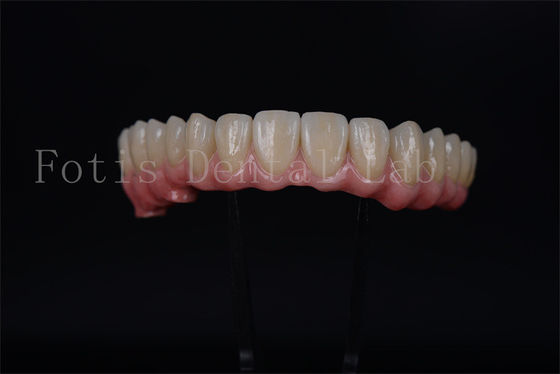 Buy Full Arch Implant Bridge All On 4 All On 6 For Complete Dental Restoration online manufacture