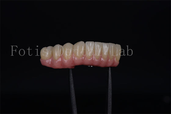 Buy Fast And Effective All On Four All On Six In A Day Implants Safety Ensured online manufacture