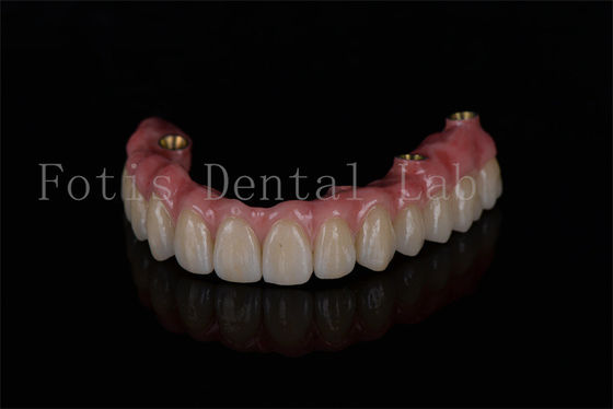 Buy Full Arch Restoration All On Four Implants For Optimal Dental Implant Performance online manufacture