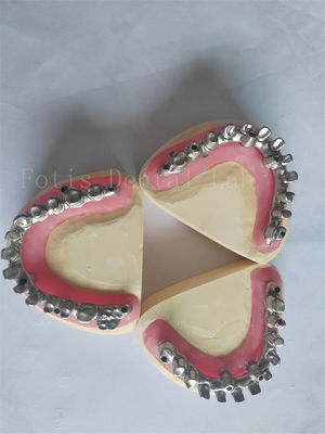 Buy Customized All On 4 All On 6 The Perfect Solution For Dental Implant Restorations online manufacture