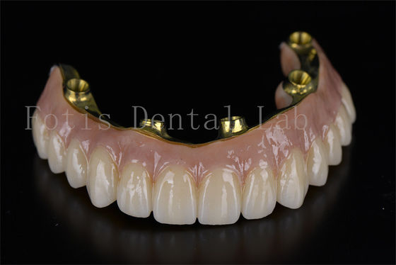 Buy Professional Efficient Treatment All On 6 Implants For Dental Issues online manufacture