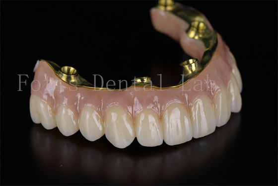 Buy Full Mouth Reconstruction All On 4 All On 6 Dental Implant System online manufacture