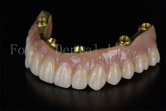 Buy Full Arch Restoration All On Six Implants Minimally Invasive Solution online manufacture