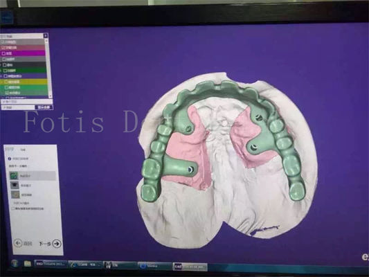 Buy Tooth Restoration Denture Design Studio Expertly Crafted For Your Satisfaction online manufacture