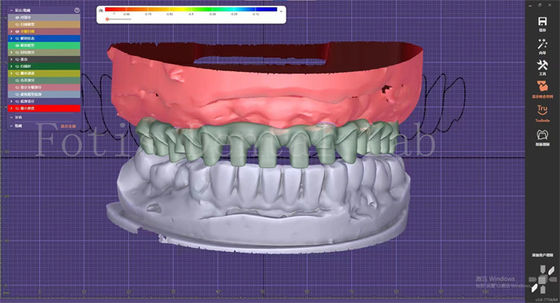 Buy OEM Mouth Models Maker Dental Design Service With Tooth Blueprint Builder online manufacture