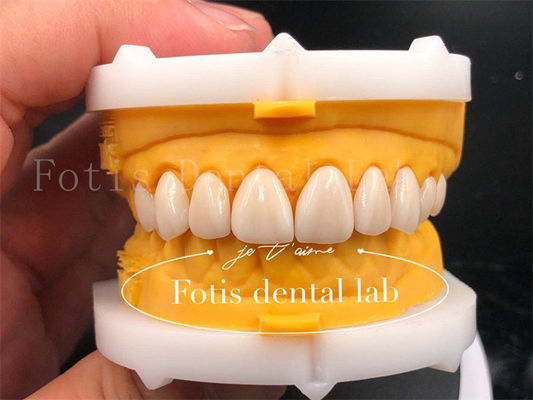 Buy Fast And Efficient Digital Dental Crowns Size Customization Tooth Implant Crown online manufacture
