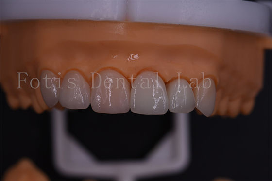 Buy 1 Day Digital Crowns Excellent Compatibility With Easy Transmission Via Email Or Software online manufacture