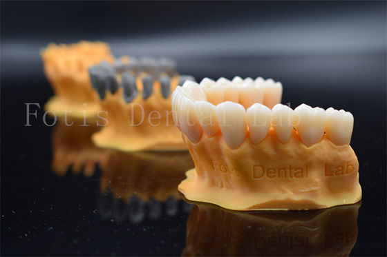 Buy Quick Full Ziconia Design Digital Crowns 3 Shape / Exo Design Same Day Manufacturing online manufacture