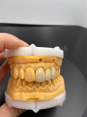 Buy Precision Fit Digital Crowns Implant Dentrues With Compatibility Email Transmission Mode online manufacture