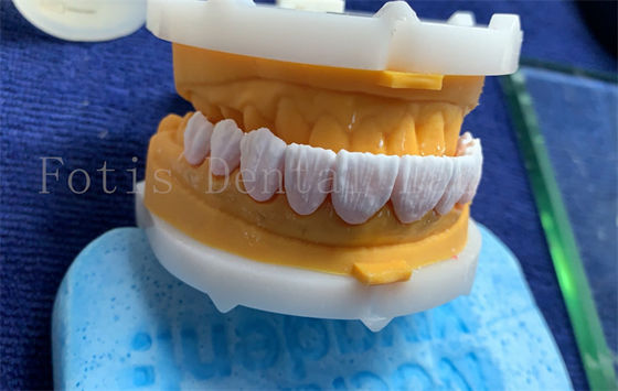 Buy Advanced Digital Dental Crowns Implant Dentrue Crown FDA/ISO/CE Certified online manufacture