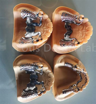 Buy Flexible Removable Partial Denture With Long Lasting Stability And Adjustable Comfort online manufacture