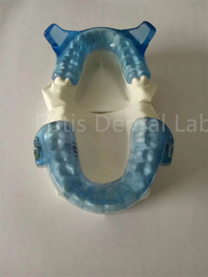 Buy Advanced Orthodontics Appliance For Superior Teeth Alignment Results online manufacture