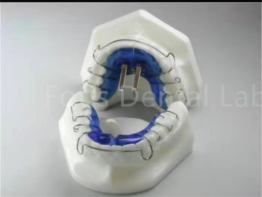 Buy Orthodontic Treatment Retainer Expander For Precise Teeth Alignment online manufacture