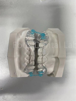 Buy Professional  Comfortable Fit Retainer Expander Orthodontic Correction Device online manufacture