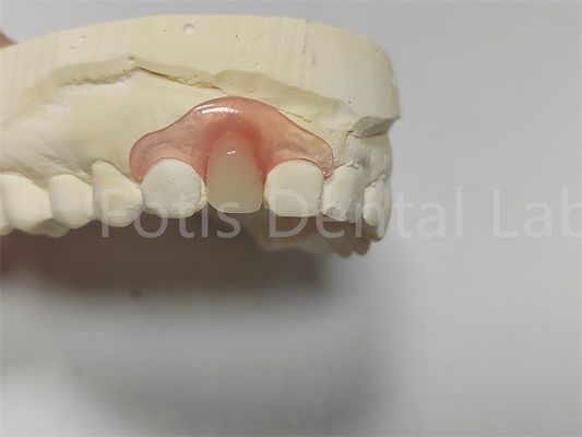 Buy Flexible Pink / Transparent Valspar Dental Partials Easy Adjustment online manufacture