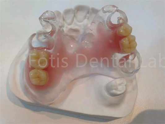 Buy Hypoallergenic Stain Resistant TCS Valplast Dental Prosthetics For Long Lasting Comfort online manufacture