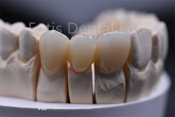 Buy Customizable Thickness Multilayer Zirconia Ceramic Dental Material online manufacture