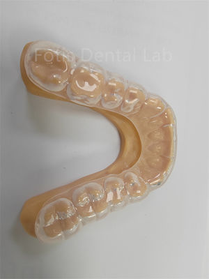 Buy Ergonomic Hard Soft Occlusal Guard Soft Teeth Guard  Long Term Use online manufacture