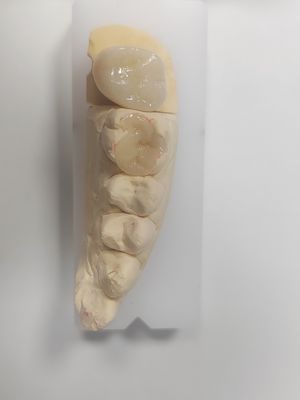 Buy Dental Inlay And Onlay For Indirect Filling And Tooth-Colored Restoration online manufacture
