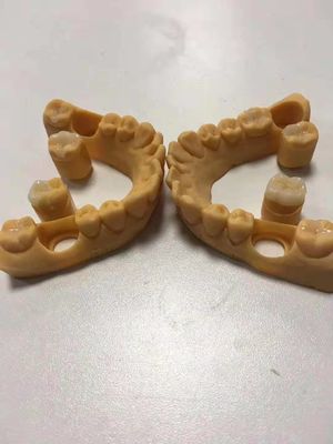 Buy Trustworthy Precise Dental Ceramic Inlays And Onlays Customizable online manufacture