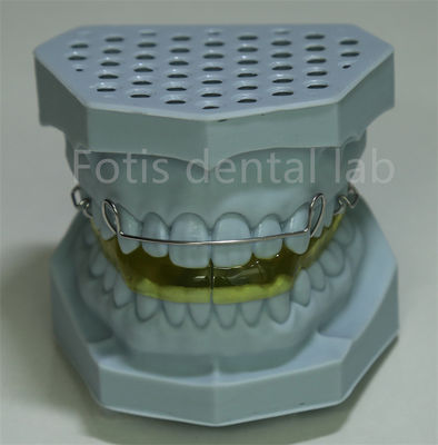 Buy China Dental Lab Lingual Wire Retainer For Teeth Expansion online manufacture