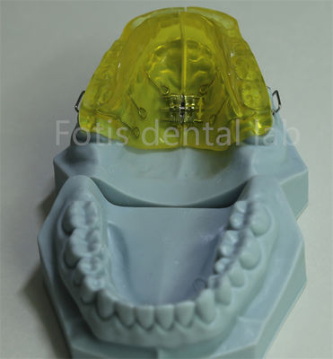 Buy Customizable Orthodontic Retainer for China Dental Lab online manufacture
