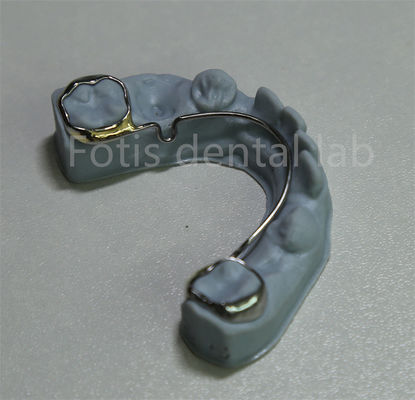 Buy China Dental Lab Orthodontic Retainer For Teeth Expansion online manufacture
