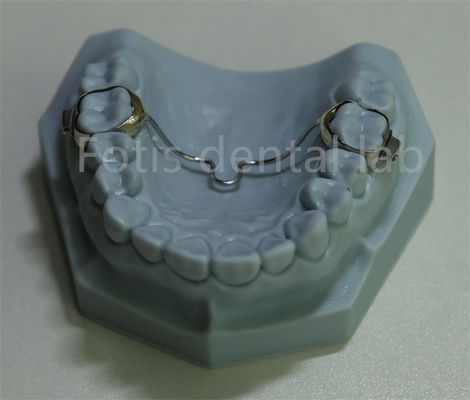 Buy Versatile Dental Expander Retainer Affordable Solution for Most Orthodontic Treatments online manufacture