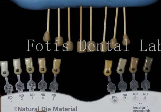Durable 0.3-0.5mm Thick Dental Lab Veneers Fake Veneers For Teeth