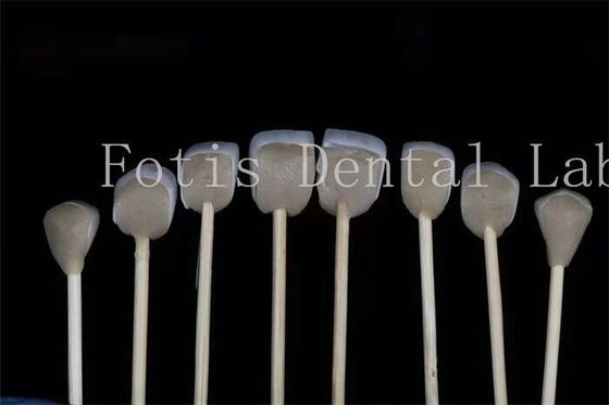 Customizable Dental Lab Laminate Veneers Compatibility with Various Tooth Preparations